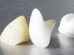 Ceramic Restoration